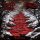 DET / CRITICAL DEFIANCE -- Bloodsurge  MLP  BLACK