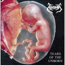 APOPLEXY -- Tears of the Unborn / Dysmorphophobia  CD