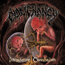 MALIGNANCY -- Intrauterine Cannibalism  LP  BLACK
